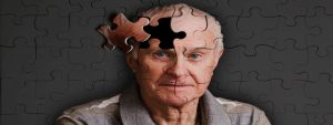 alzheimer